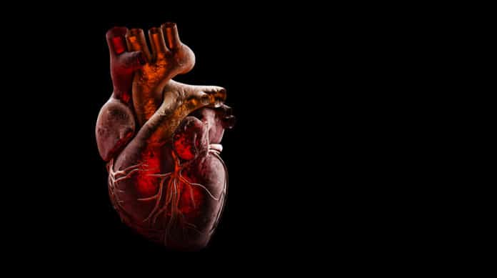 Model of human heart failure