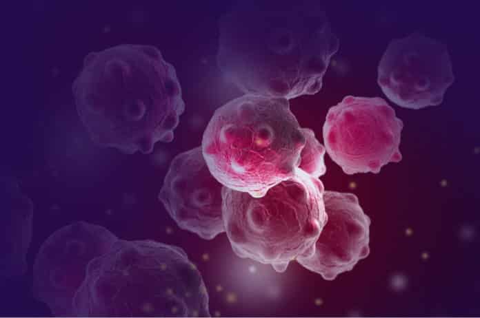 Cancer biomarker in urine