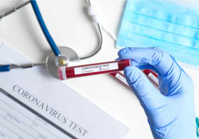 Oxford University Begins Its Coronavirus Vaccine Clinical Trials On Humans