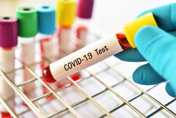Treatment Trials for COVID-19 by Sanofi and Regeneron