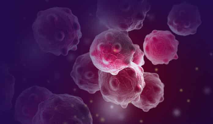 Purdue University Innovators Developed A Novel Wearable Patch To Treat Skin Cancer