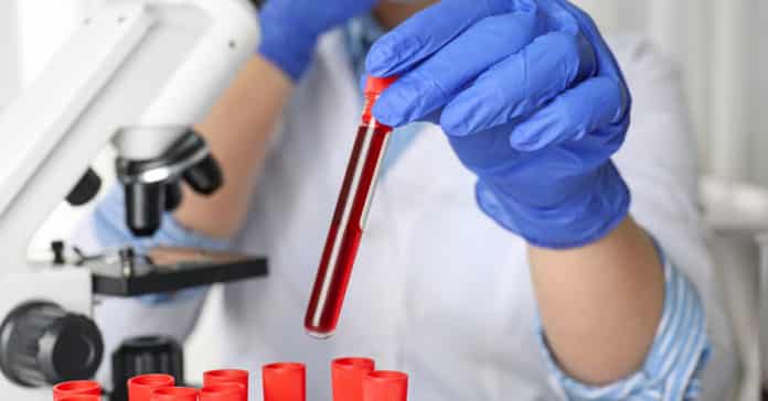 Kemin Microbiology Job Opening 2020 - Apply Online