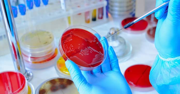 Moderna Freshers Microbiology Job Opening - Apply