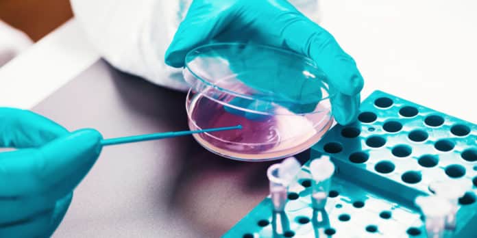 AbbVie Microbiology Lab Analyst Vacancy - Apply Online