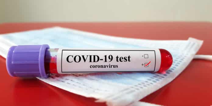 20-Second COVID-19 Screening Test Piloted At Heathrow Airport, London