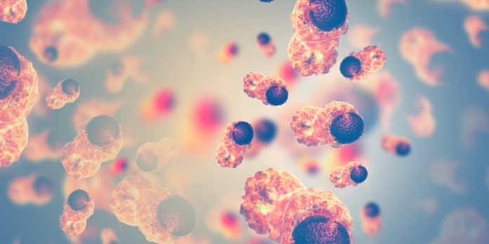Gene Associated with Ovarian Cancer Identified