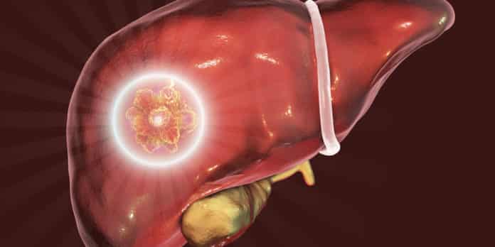Checkpoint Inhibitor Drug, an Immuno-oncology Combination, Resists Liver Tumor in Mice.