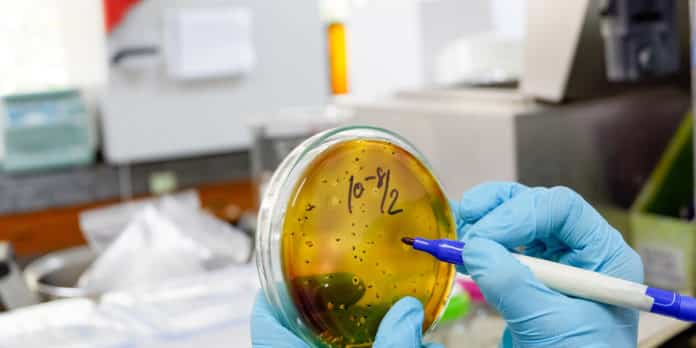 RB R&D Associate Vacancy - Microbiology & Virology