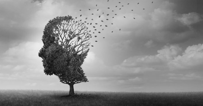 New Prospective Technology To Understand Alzheimer's Progression