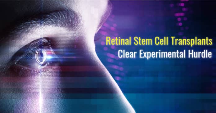 Retinal Stem Cell Transplants