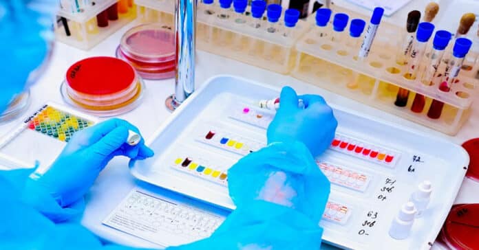 P&G Environmental Associate Scientist Vacancy - Apply Online