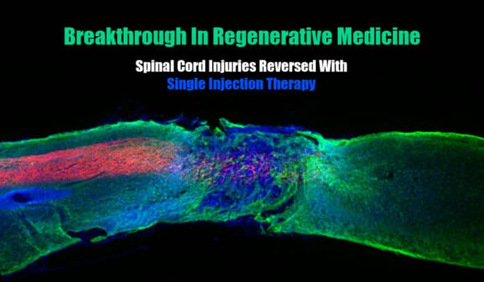 The Novel Therapy To Reverse Paralysis