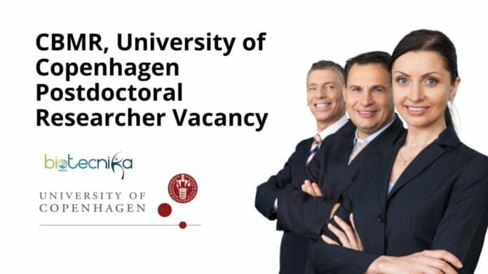CBMR, University of Copenhagen Postdoctoral Researcher Vacancy