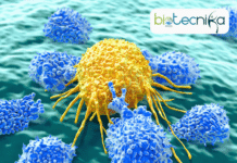 Shocking Statistics: Cancer Incidence Soars 80% in Under-50s, Per New Study Alarming Rise: Cancer Rates in Under-50s Surge by 80% Over 30 Years