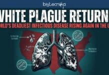 White Plague Returns: World’s Deadliest Infectious Disease Rising Again in the USA White Plague also known as Tuberculosis, is rising again in the USA. Here’s what you need to know about symptoms, causes, and prevention.